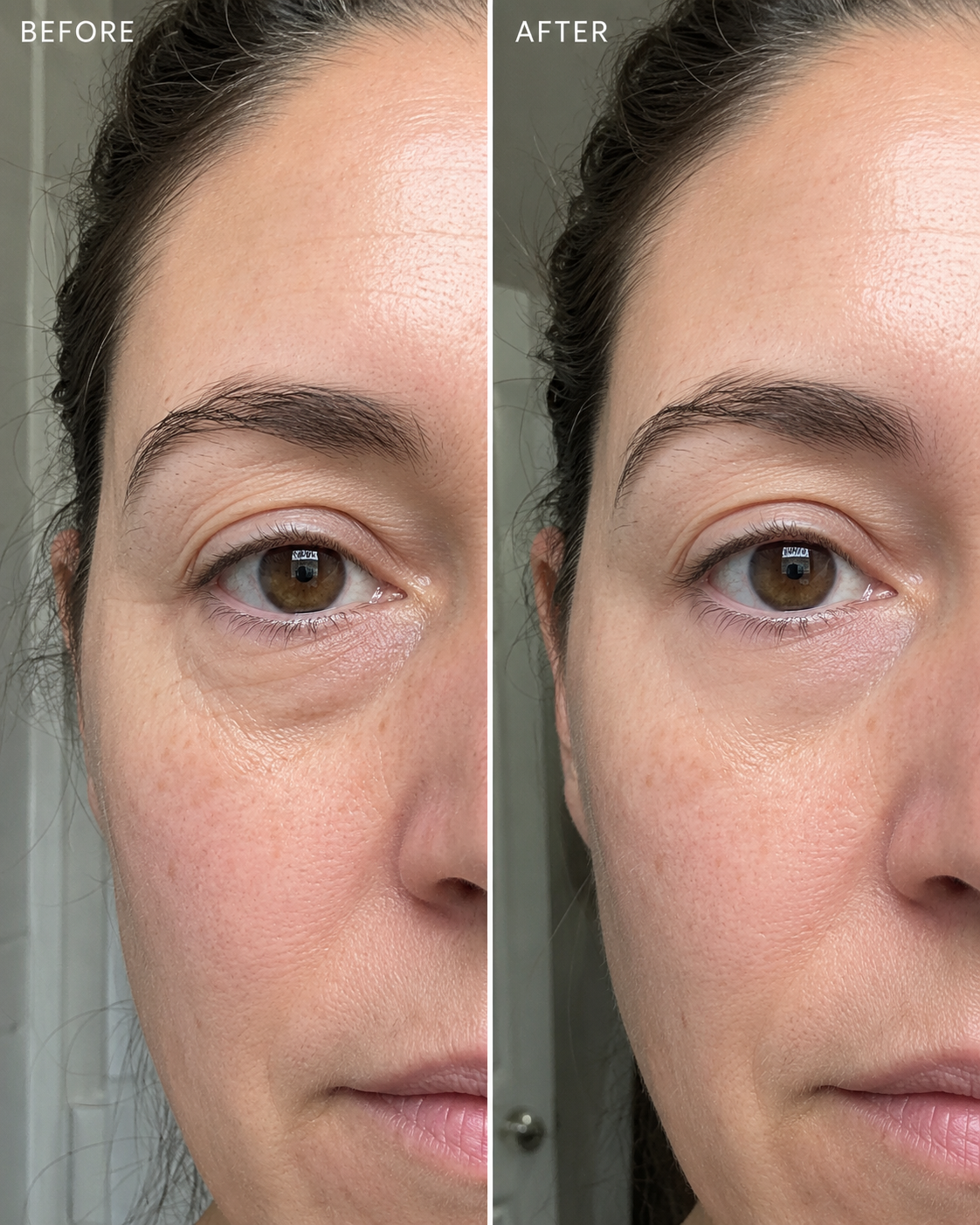 Renata M. before and after